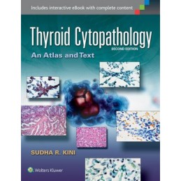 Thyroid Cytopathology: An...