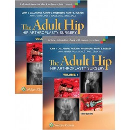 The Adult Hip (Two Volume...