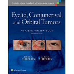 Eyelid, Conjunctival, and...