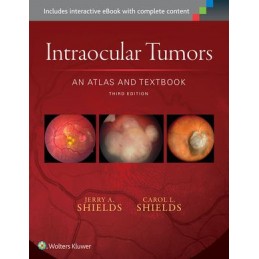 Intraocular Tumors: An...