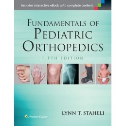 Fundamentals of Pediatric Orthopedics