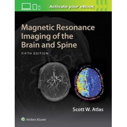 Magnetic Resonance Imaging...