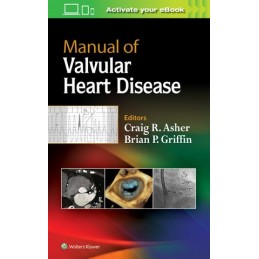 Manual of Valvular Heart...