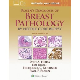 Rosen's Diagnosis of Breast...