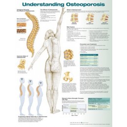 Understanding Osteoporosis...
