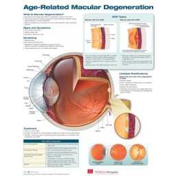 Age-Related Macular...