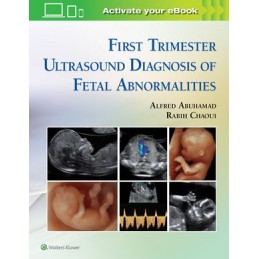 First Trimester Ultrasound...
