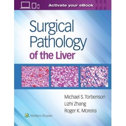 Surgical Pathology of the...
