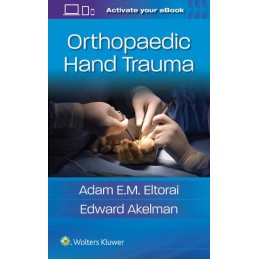 Orthopaedic Hand Trauma