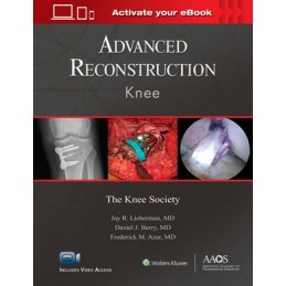 Advanced Reconstruction: Knee: Print + digital version with Multimedia