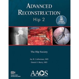 Advanced Reconstruction: Hip 2: Print + digital version with Multimedia