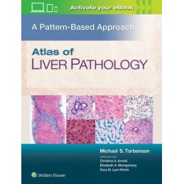 Atlas of Liver Pathology: A...
