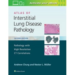 Atlas of Interstitial Lung...