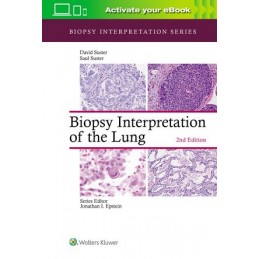 Biopsy Interpretation of...