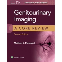 Genitourinary Imaging: A Core Review