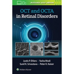 OCT and OCTA in Retinal...
