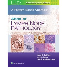 Atlas of Lymph Node Pathology: A Pattern Based Approach