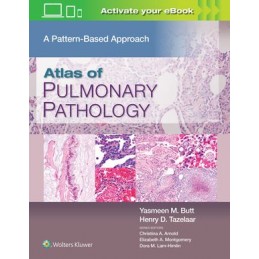 Atlas of Pulmonary Pathology: A Pattern Based Approach