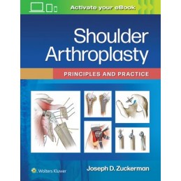 Shoulder Arthroplasty: Principles and Practice