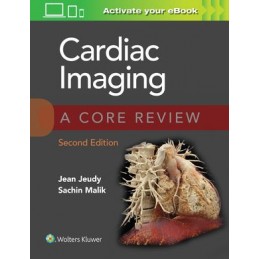 Cardiac Imaging: A Core Review