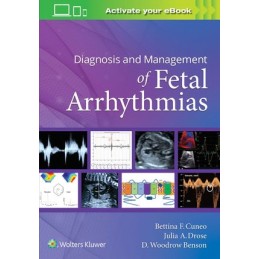 Diagnosis and Management of Fetal Arrhythmias