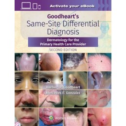 Goodheart's Same-Site Differential Diagnosis: Dermatology for the Primary Health Care Provider