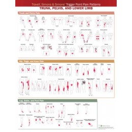 Travell, Simons & Simons' Trigger Point Pain Patterns Wall Chart: Trunk, Pelvis, and Lower Limb