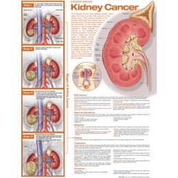 Understanding Kidney Cancer Anatomical Chart