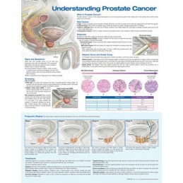 Understanding Prostate...