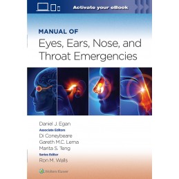 Manual of Eye, Ear, Nose, and Throat Emergencies