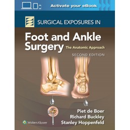 Surgical Exposures in Foot and Ankle Surgery: The Anatomic Approach