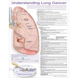 Understanding Lung Cancer...