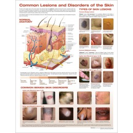 Common Lesions and...