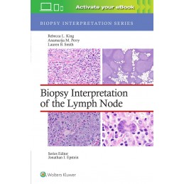 Biopsy Interpretation of the Lymph Node