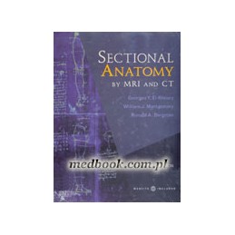 Sectional Anatomy by MRI...