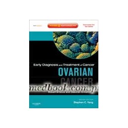 Early Diagnosis and Treatment of Cancer Series: Ovarian Cancer