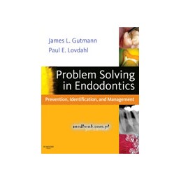 Problem Solving in Endodontics