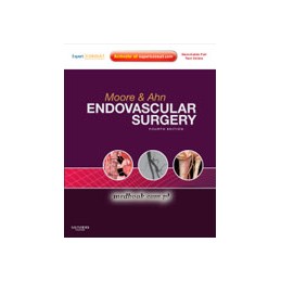Endovascular Surgery
