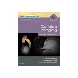 Cardiac Imaging: Case Review Series