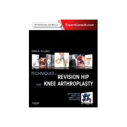 Techniques in Revision Hip...