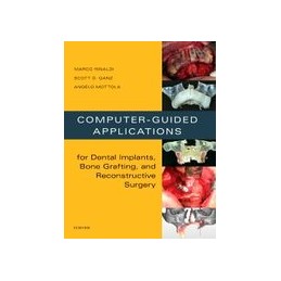 Computer-Guided Applications for Dental Implants, Bone Grafting, and Reconstructive Surgery (adapted translation)