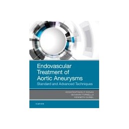 Endovascular Treatment of...
