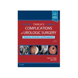 Complications of Urologic Surgery