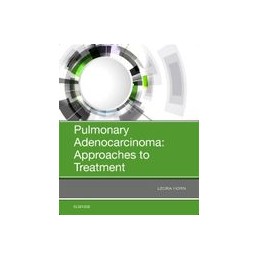 Pulmonary Adenocarcinoma:...