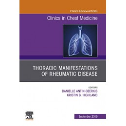 Thoracic Manifestations of Rheumatic Disease, An Issue of Clinics in Chest Medicine