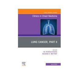 Lung Cancer, Part II, An Issue of Clinics in Chest Medicine