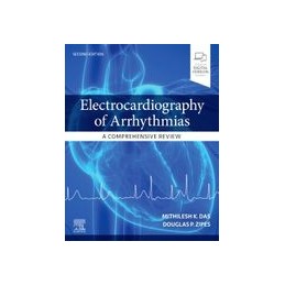 Electrocardiography of...