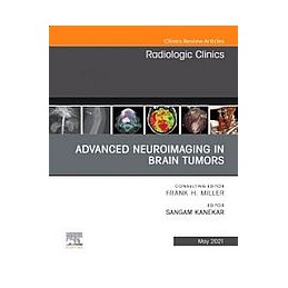 Advanced Neuroimaging in...
