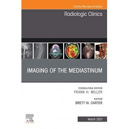Imaging of the Mediastinum,...