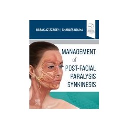 Management of Post-Facial...